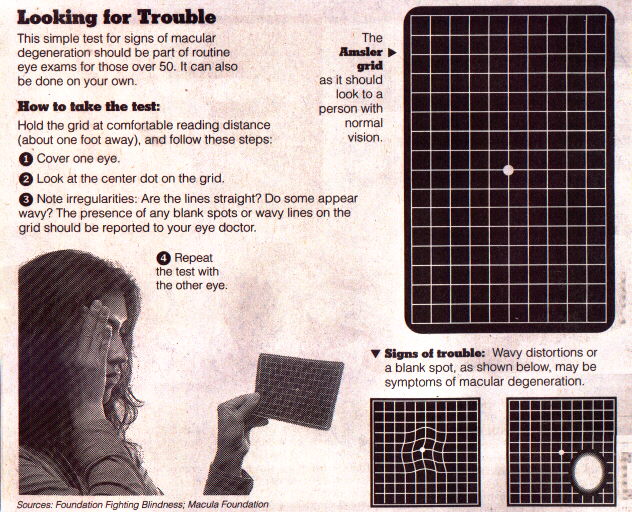 Amsler Grid: A Quick Test For Macular Degeneration and Other Vision  Problems — Sunshine Optometry